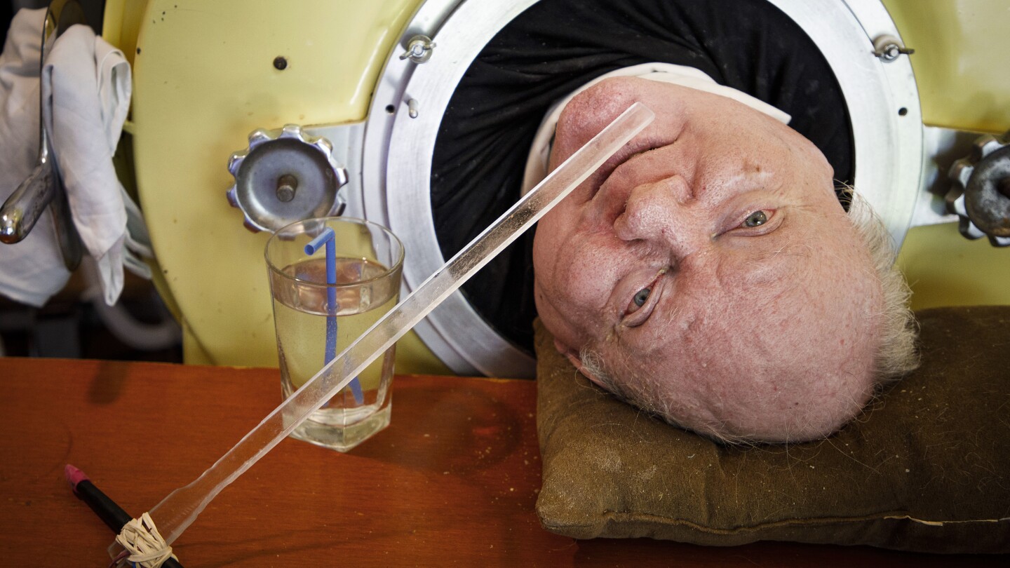 Featured image for "Paul Alexander, Longtime Iron Lung User, Passes Away at 78"