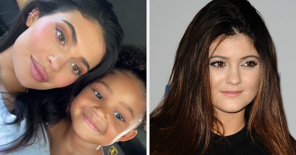 Kylie Jenner Opens Up About Her Natural Features, Lip Fillers, and Self-Love.