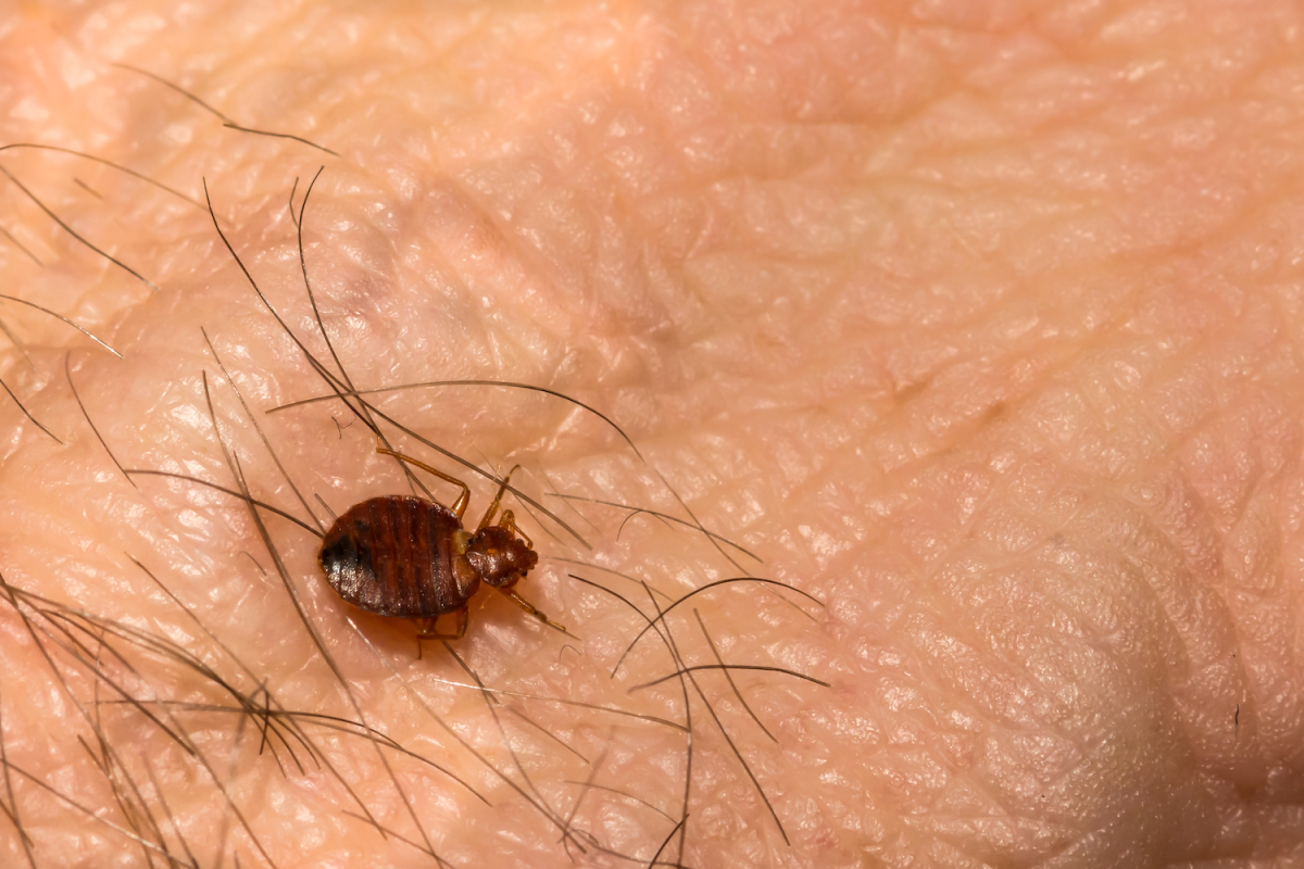 "Bold Bed Bug Expert Sacrifices Arm for Research on Blood-Sucking Pests"