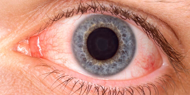 Featured image for FDA warns against using amniotic fluid as eye drops.