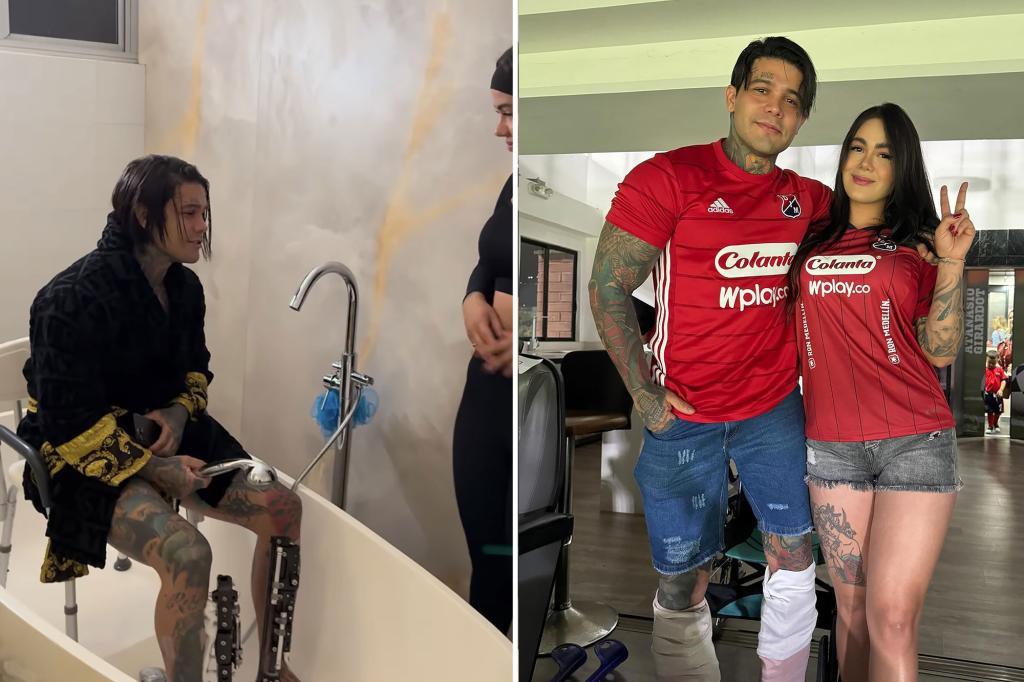 Man Spends $175K on Painful Surgery to Grow 6 Inches