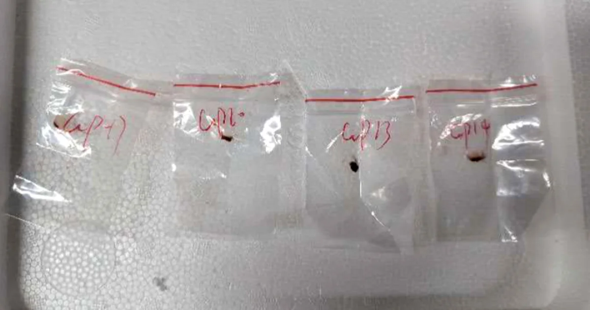 Featured image for Chinese Couple Charged with Smuggling Pathogenic Fungus into the U.S.