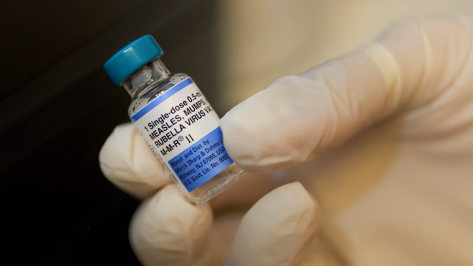 Measles Outbreaks Spread Across U.S. Amid Vaccination Challenges