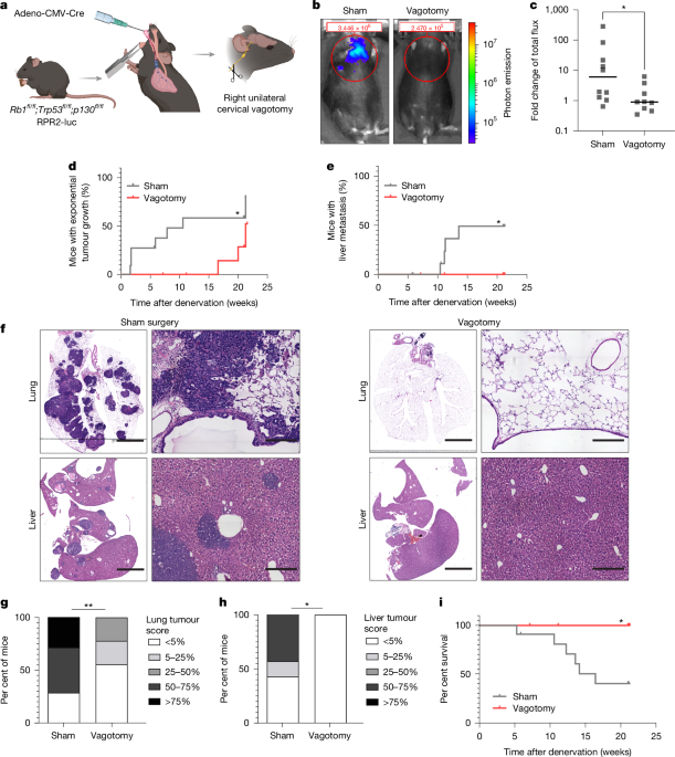 Featured image for Small Cell Lung Cancer Exploits Brain Neuronal Synapses to Promote Growth