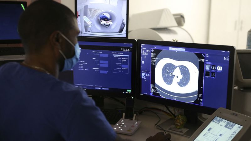 Improving Lung Cancer Survival Rates: The Overlooked Solution
