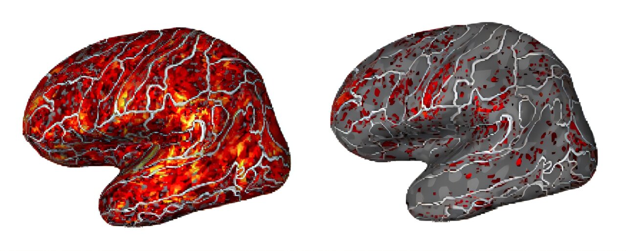 Featured image for Neurocomputational Insights into Brain's Organization of Conversation