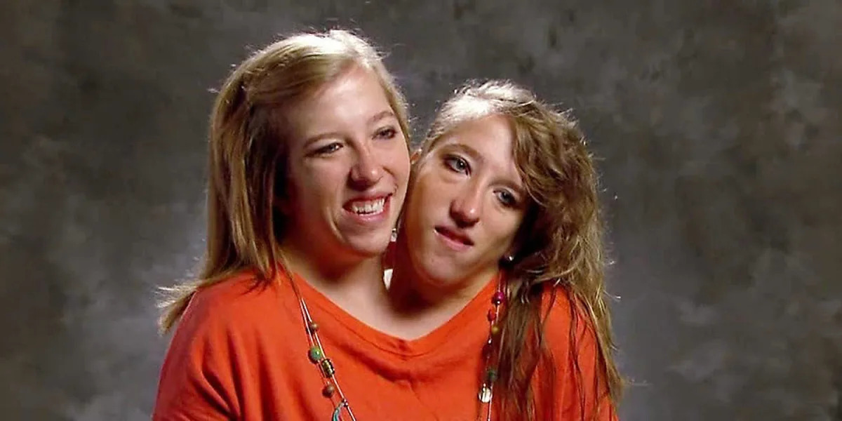 "Conjoined Twin Abby Hensel Ties the Knot"