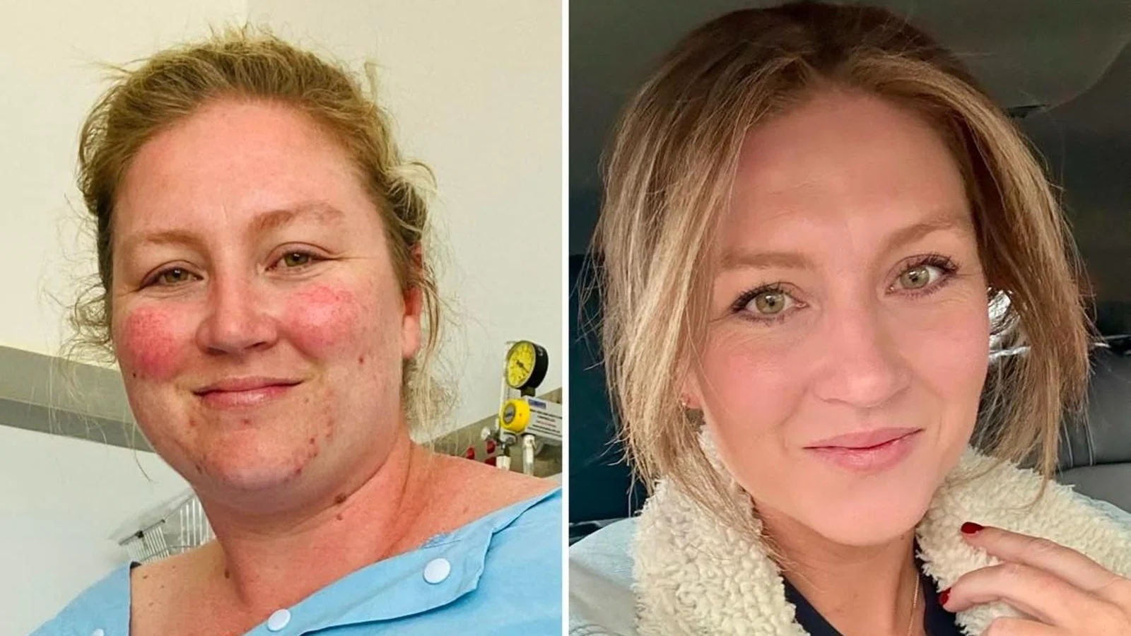 Featured image for Woman Shares 5 Simple Habits That Helped Her Lose Over 50 Kg