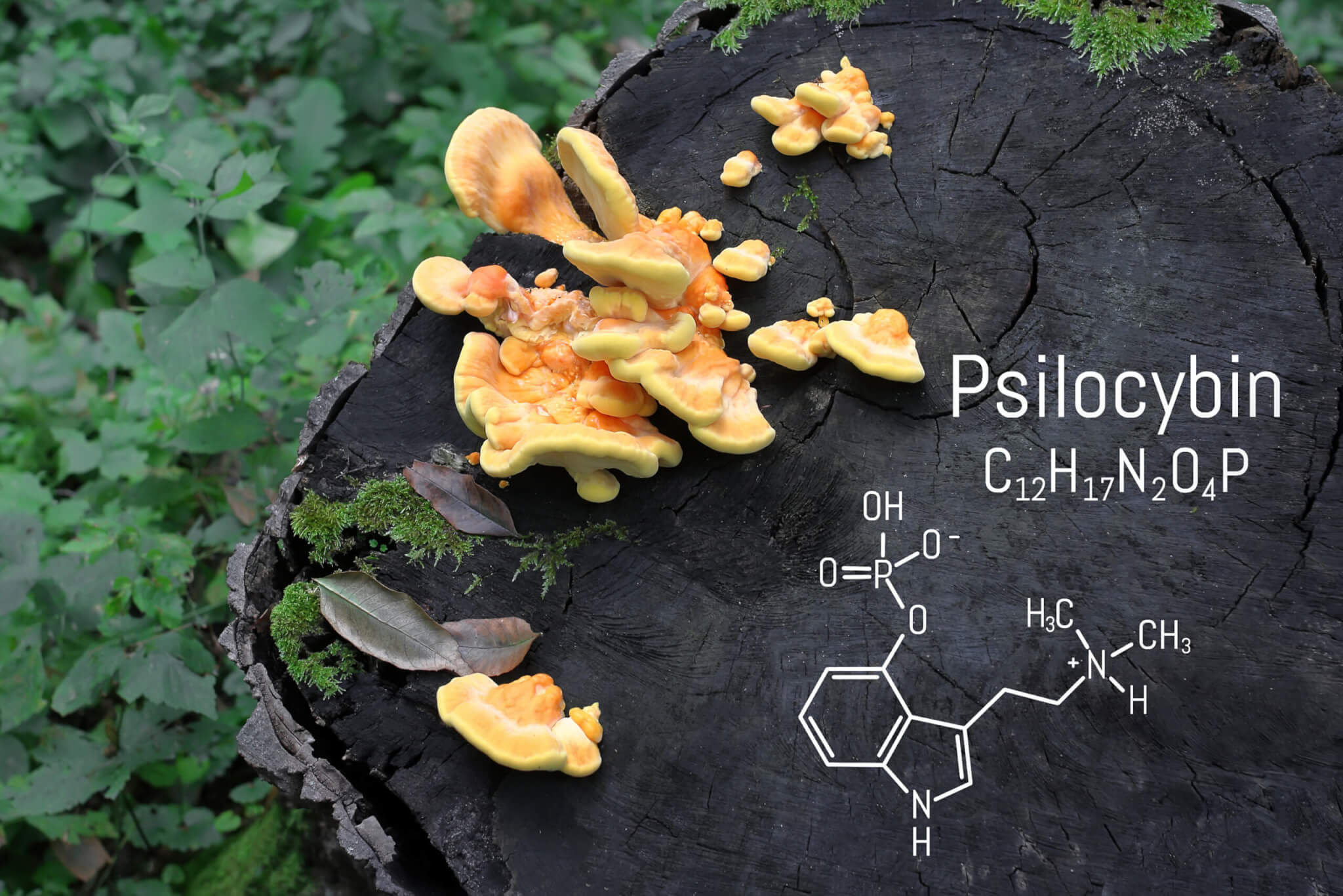 Featured image for Doctor Tests Psilocybin as Potential IBS Treatment