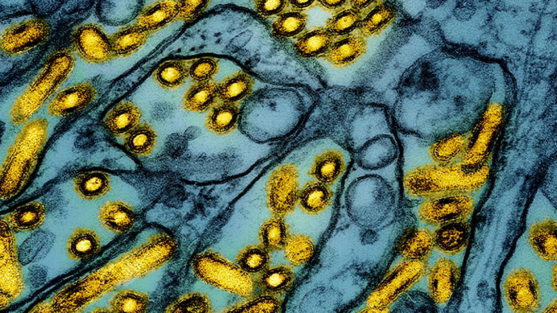 Oregon Reports First Human Bird Flu Case Confirmed by CDC