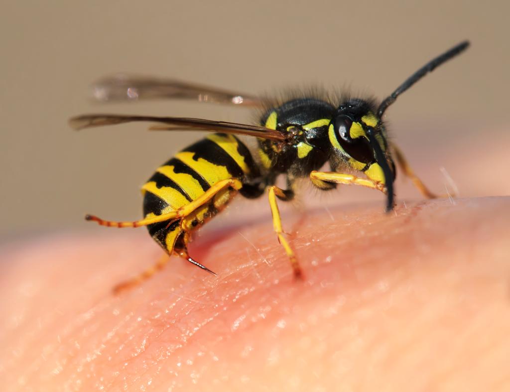 Wasp stings linked to strokes in medical case study