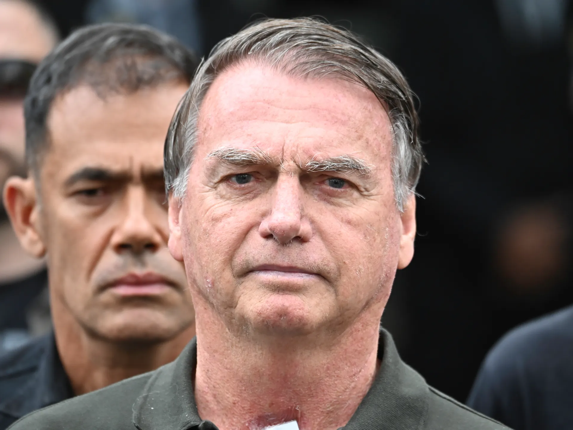 Featured image for Brazil's Bolsonaro undergoes hernia surgery after court approval