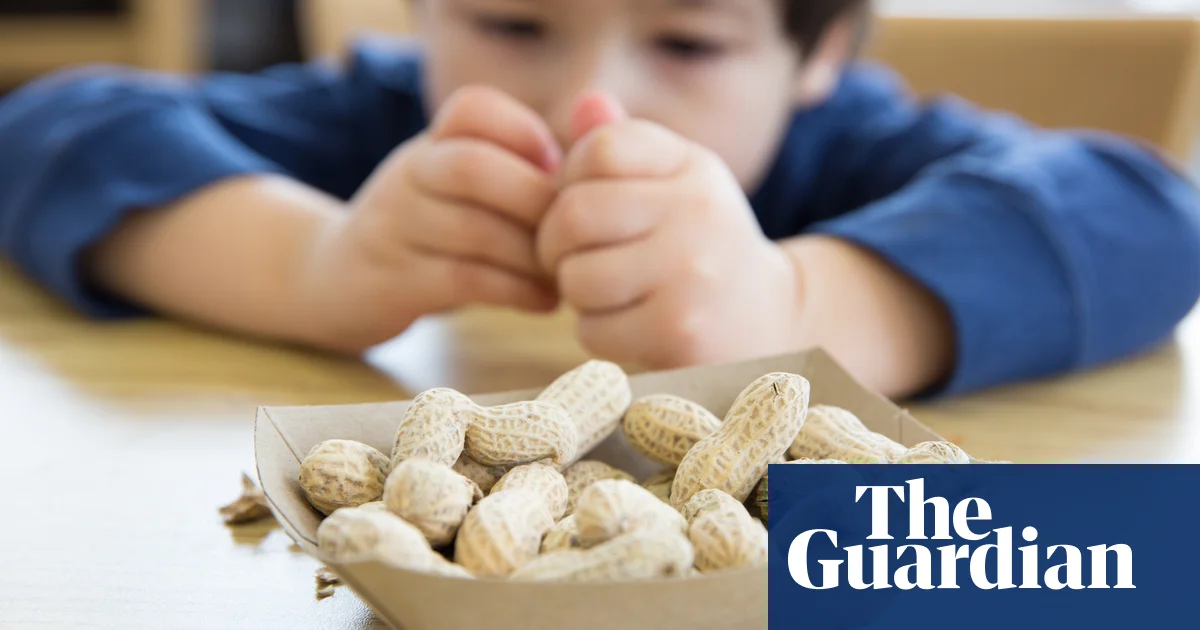 Featured image for Feeding Babies Peanuts Reduces Allergy Risk, Study Confirms