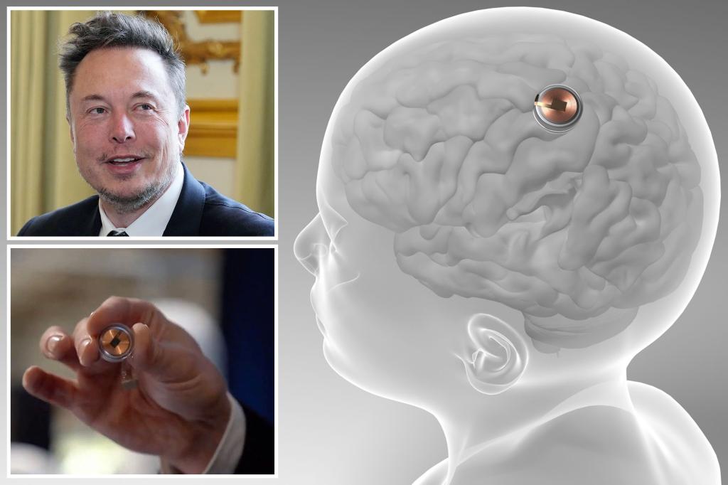 Neuralink receives FDA approval for human brain implant trials.