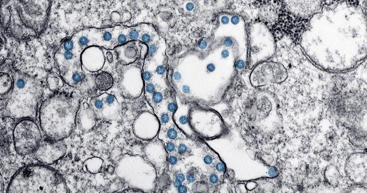 Featured image for Breakthrough Air Monitor Detects COVID-19 and Other Viruses in Real-Time