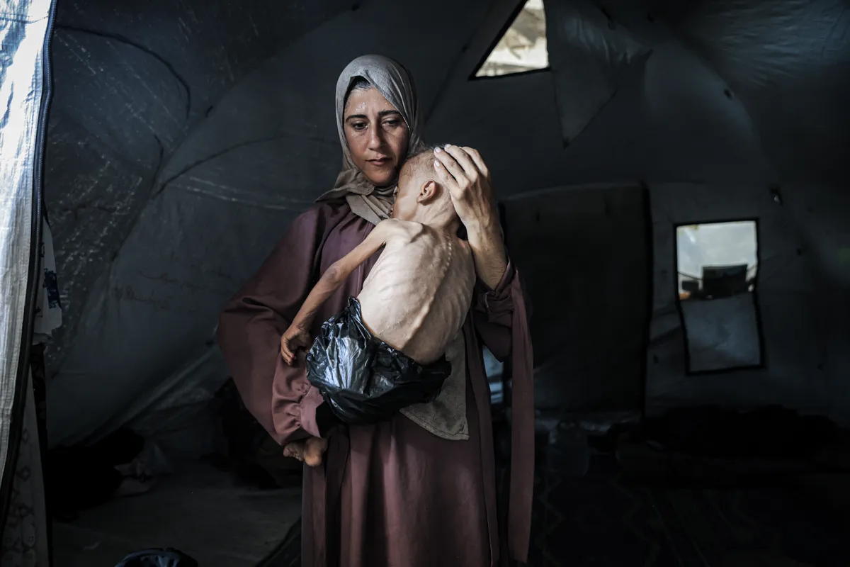 Featured image for Controversy and Impact of Images Depicting Starvation in Gaza