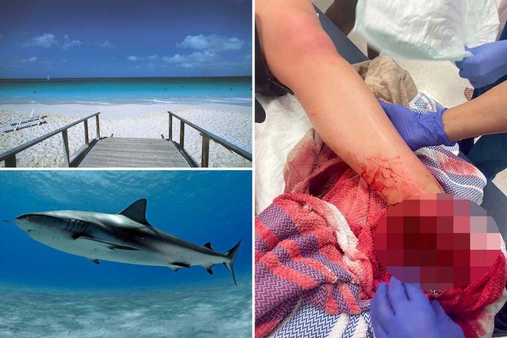 American tourist loses foot in shark attack during Turks and Caicos vacation.