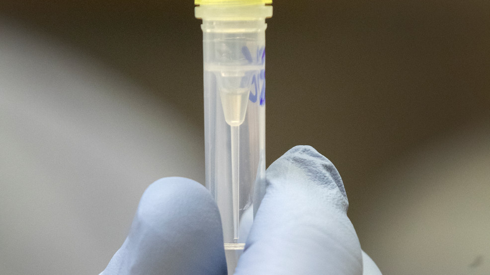 Featured image for "Rising Covid Variant Sparks Concern in Lane County"