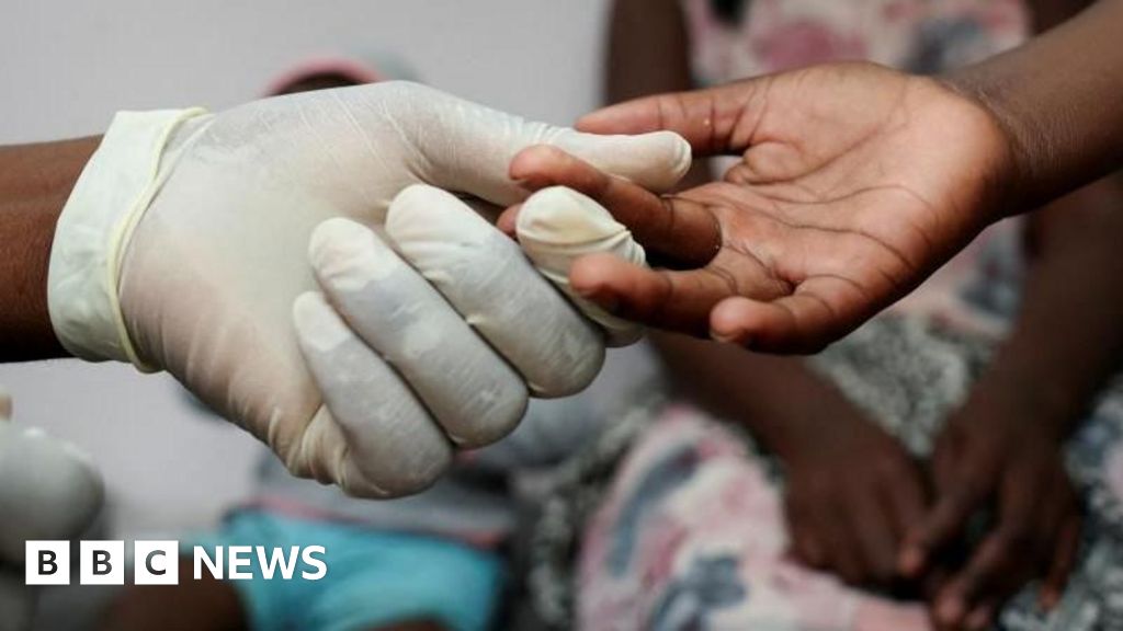Featured image for Global HIV Funding Crisis Sparks Fears of Increased Deaths and Treatment Disruptions