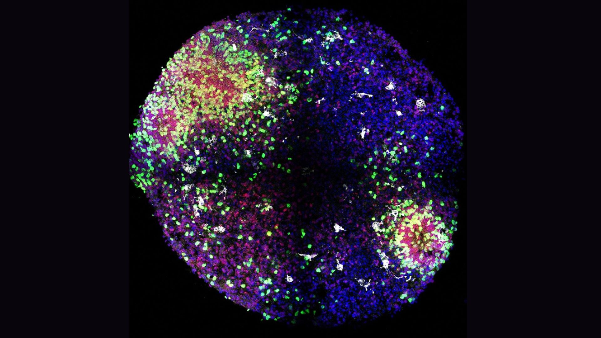 Featured image for Advances in Lab-Grown Mini Brains Unveil Brain Development Secrets