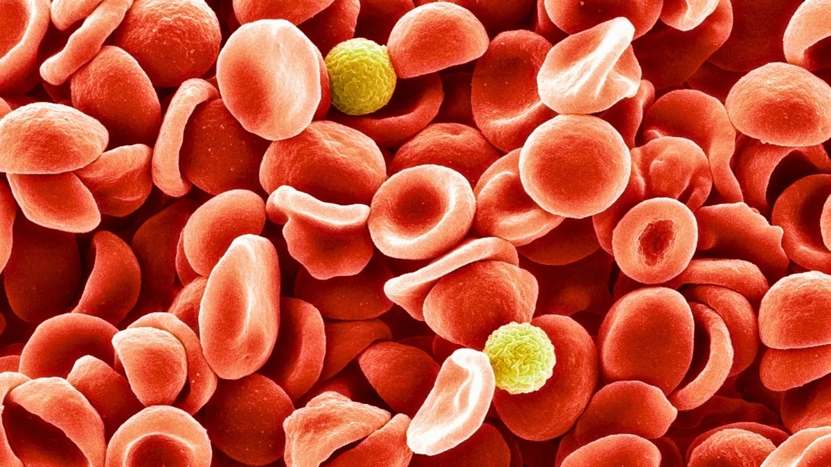 New MAL Blood Group Solves a 50-Year Transfusion Mystery
