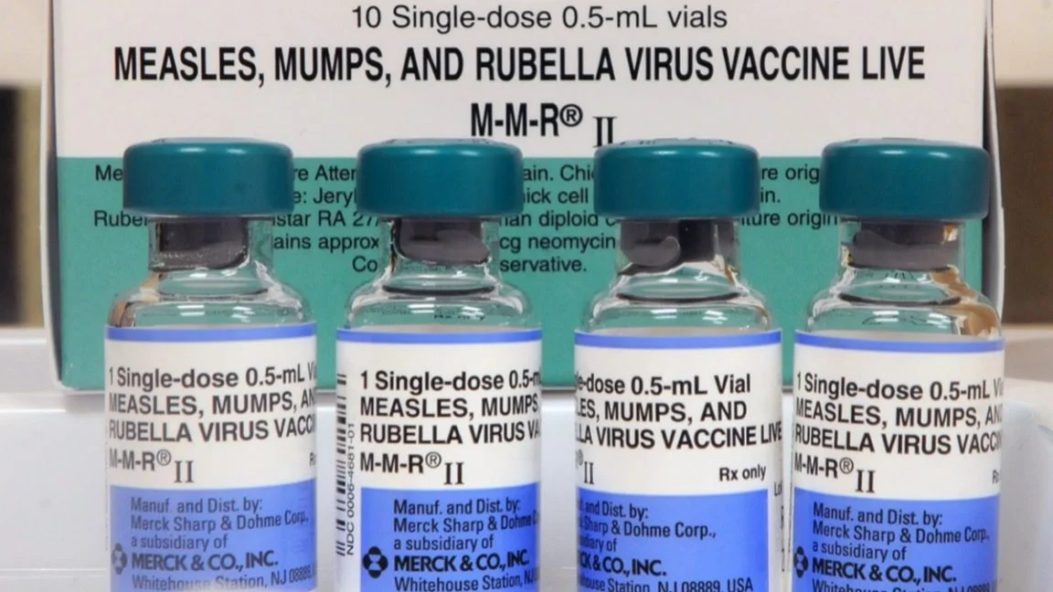 SC measles outbreak rockets to 434 cases, 409 quarantined as vaccination drive expands