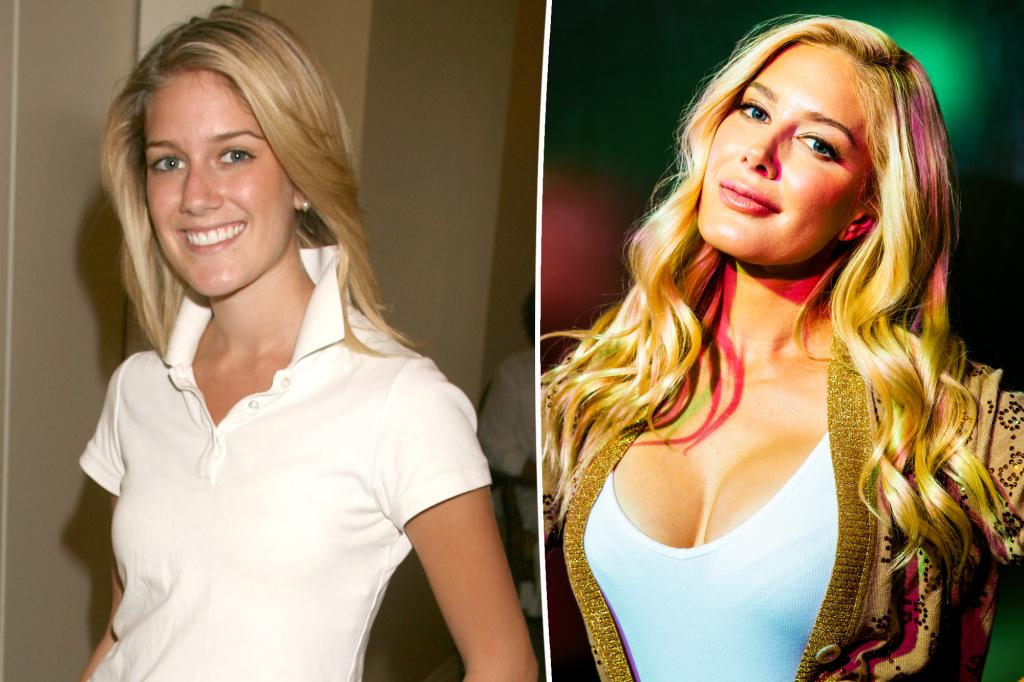 Featured image for Heidi Montag's Infamous Plastic Surgery: The Gruesome Detail of Her Jaw Sawing