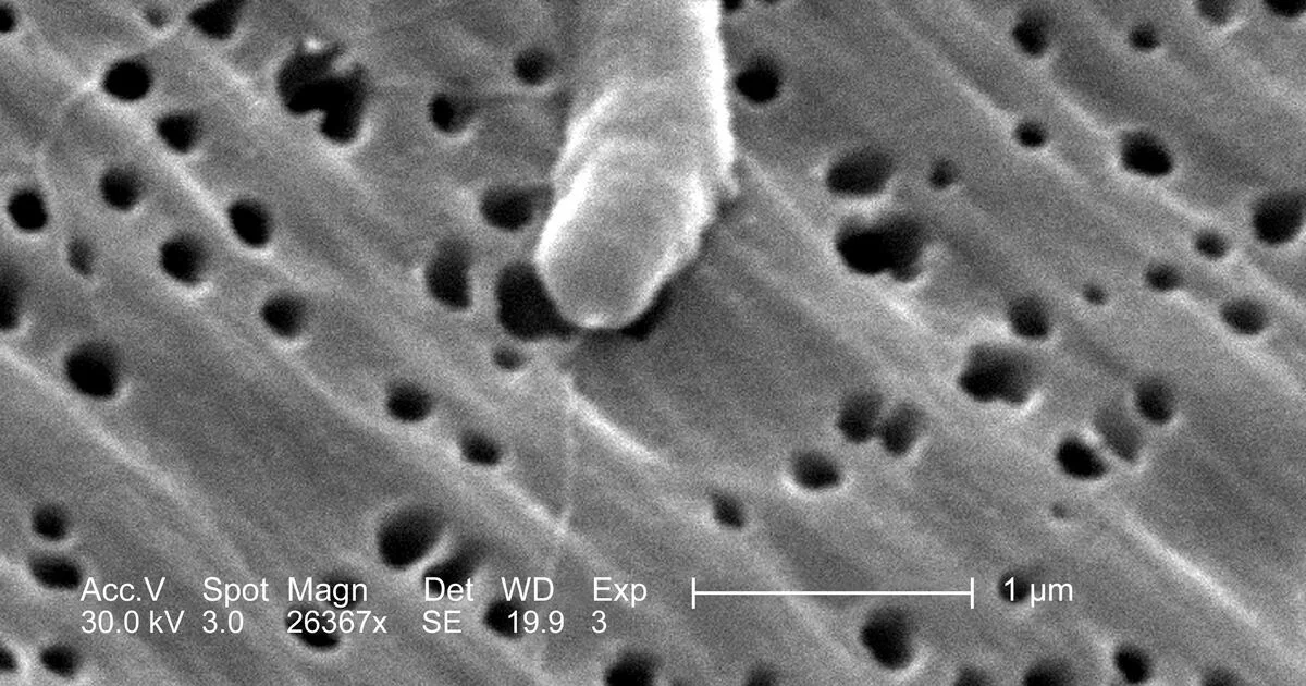 Tragic Deaths from Flesh-Eating Bacteria: What is Vibrio vulnificus?