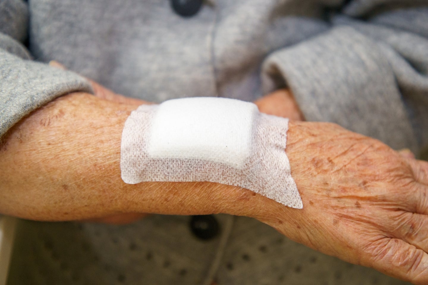 Featured image for "Age-Defying Healing: Boosting Wound Recovery in the Aging Process"