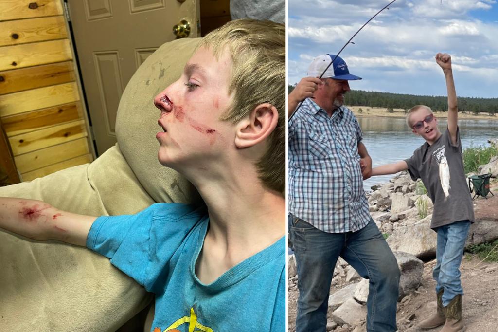 Featured image for Teen Survives Bear Attack in Arizona Cabin