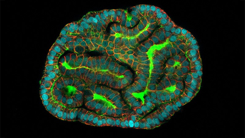 Featured image for "Amniotic Fluid-Derived Organoids: A Breakthrough in Prenatal Medicine"