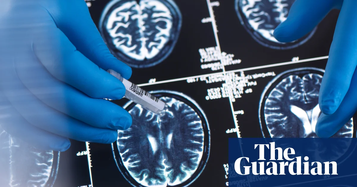 Featured image for Brain scans reveal optimism's shared neural patterns and pessimism's diversity