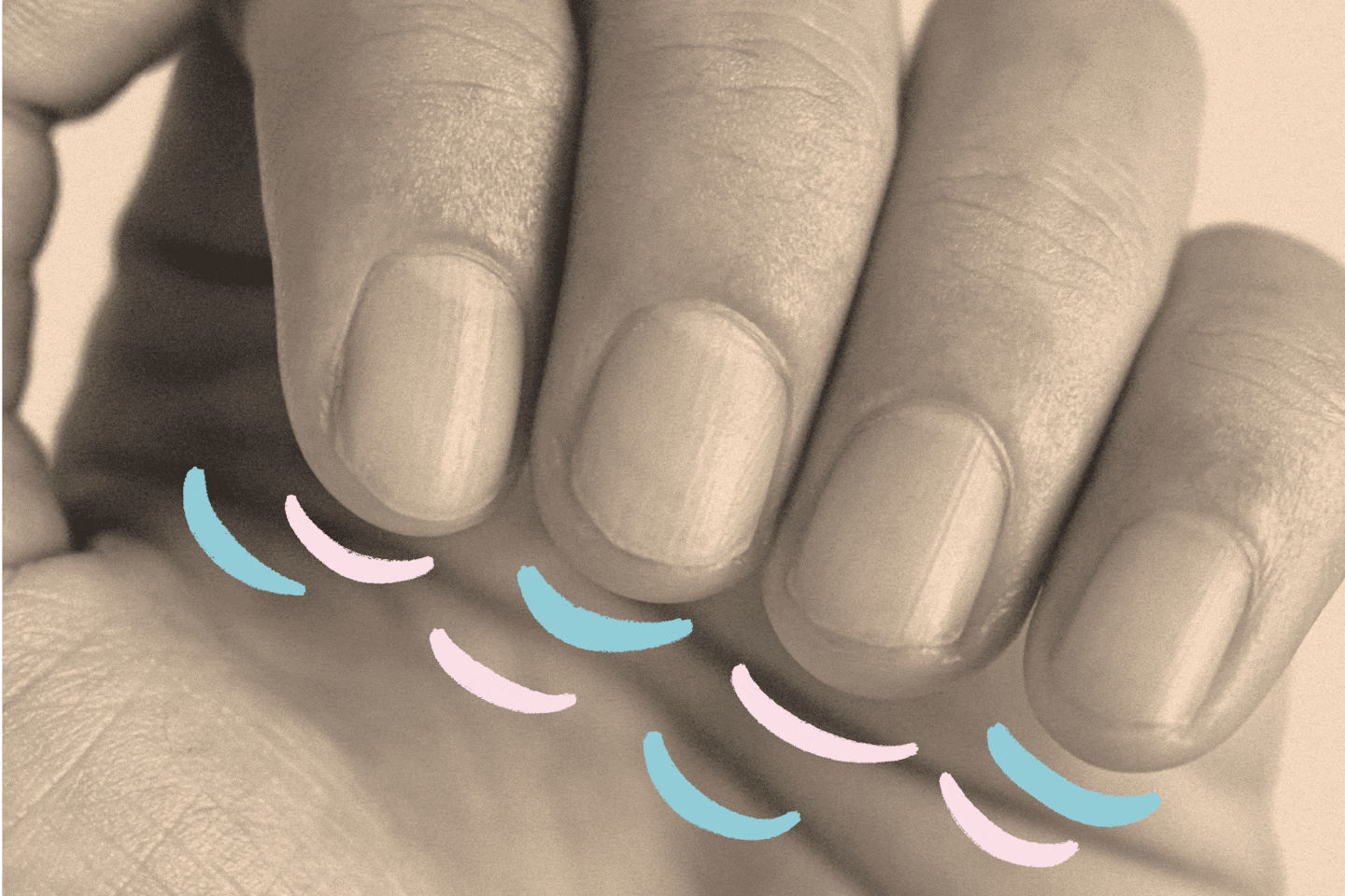 Featured image for Cracked or Discolored Nails? Here's What It Could Mean for Your Health