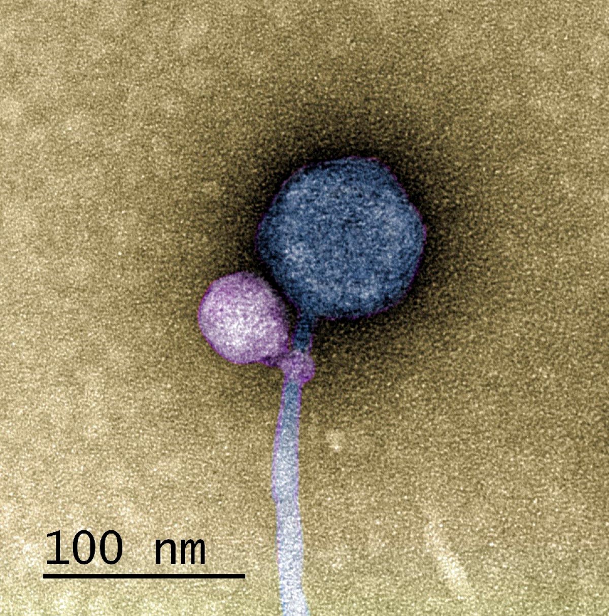 Featured image for Unprecedented Virus Interaction Leaves Scientists Astonished