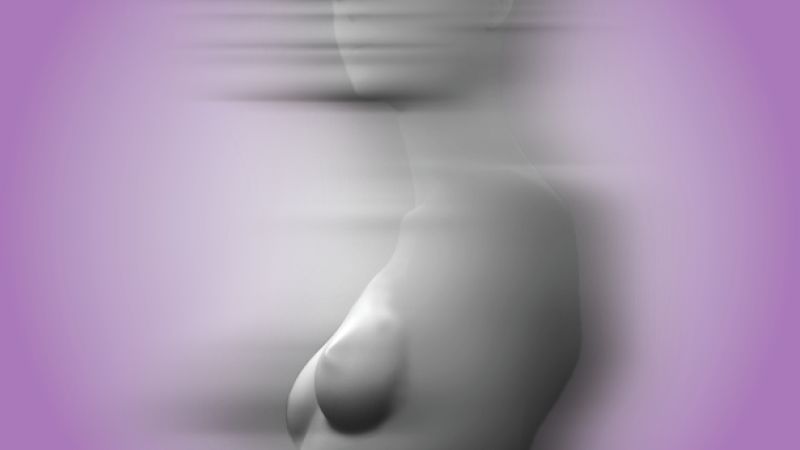 Featured image for Rising Trend of Breast Explant Surgery: Is It Your Choice?