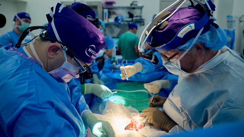 Featured image for Groundbreaking Transplant: Pig Kidney Successfully Transplanted into Human in Record-Breaking Procedure