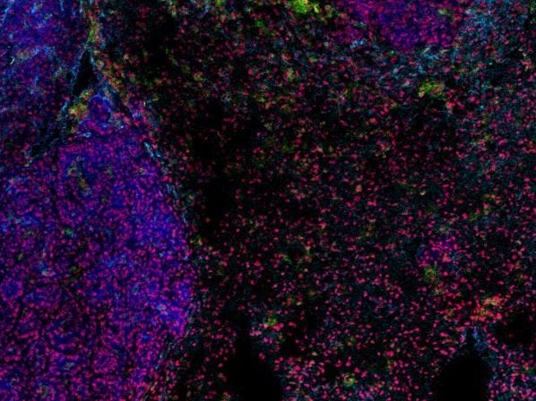 Featured image for Ancient virus holds potential for lung cancer treatment.