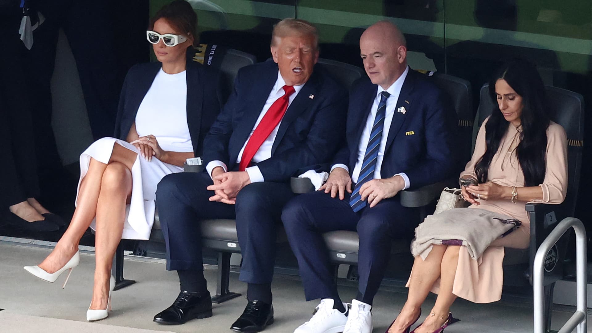 Featured image for Trump diagnosed with chronic venous insufficiency after leg swelling