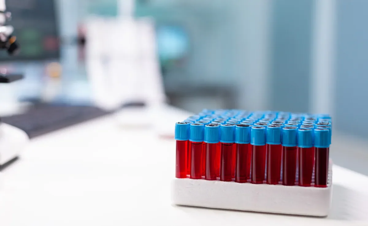 AHA's 2026 Dyslipidemia Guideline: Start Screening Early for Lifelong Heart Health