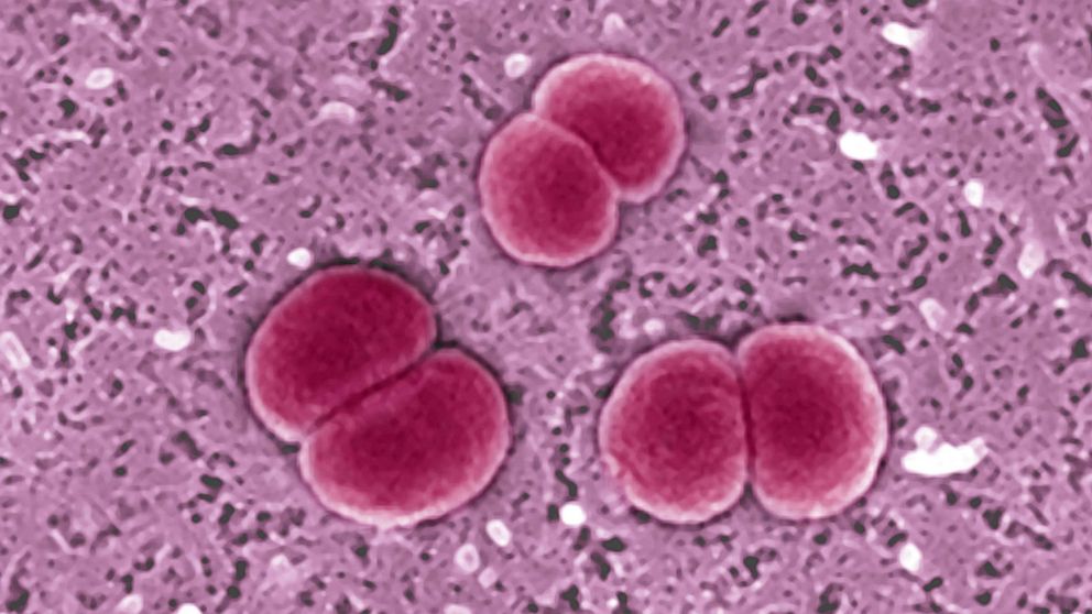 "Statewide Meningococcal Disease Outbreak Hits Virginia"