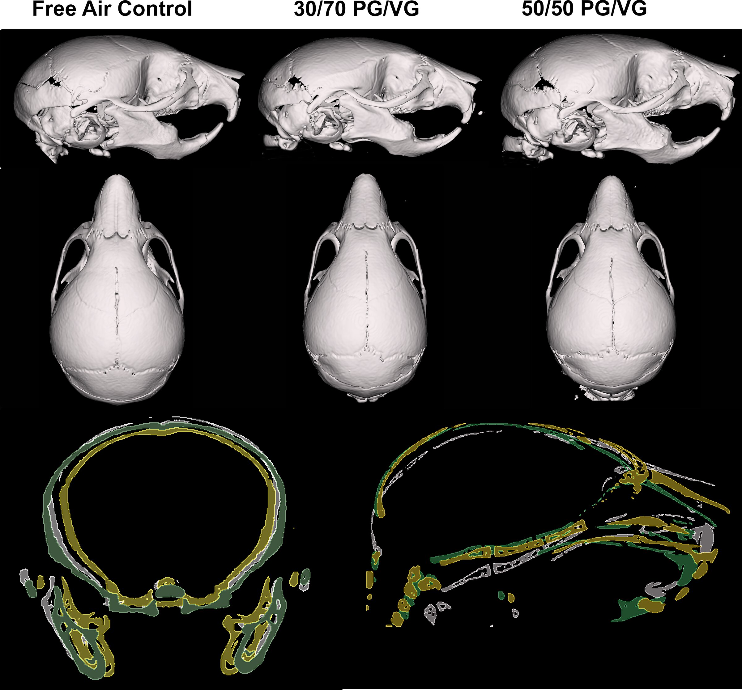 Featured image for Vaping During Pregnancy Alters Fetal Skull Development