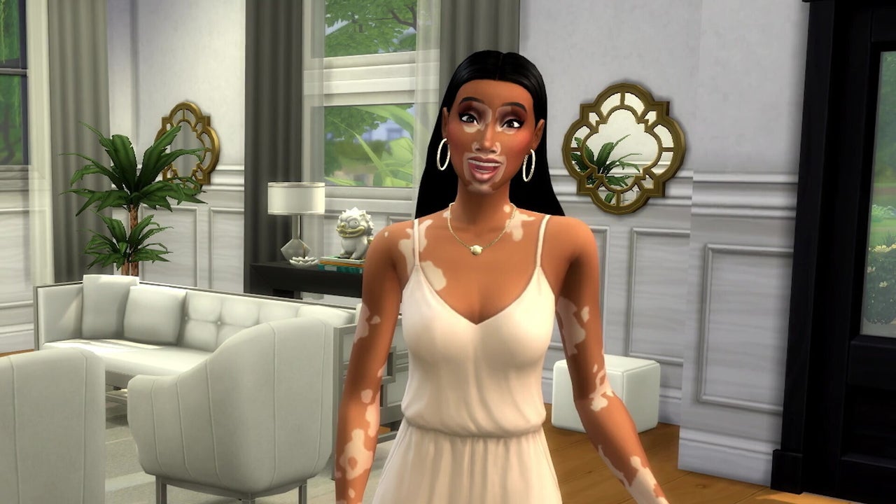 Featured image for "The Sims 4 Introduces Vitiligo Skin Feature in Collaboration with Winnie Harlow"