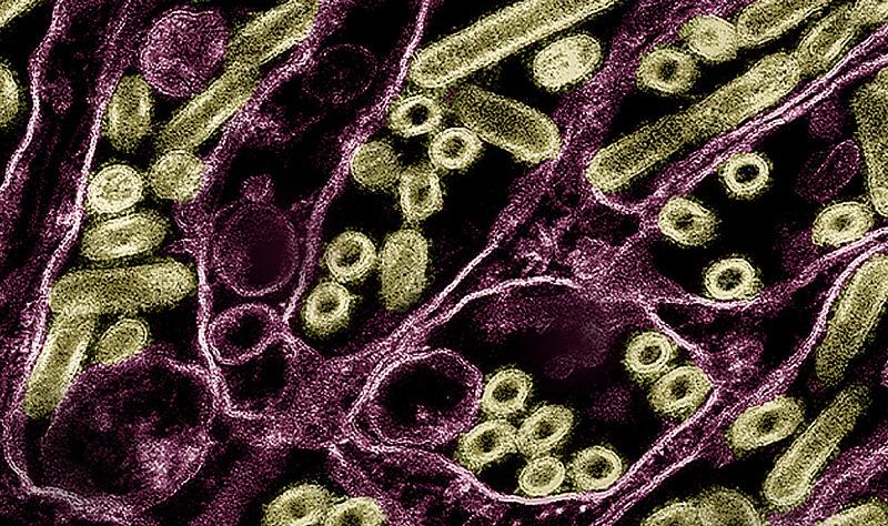 Canadian Teen in Critical Condition with First Human Bird Flu Case