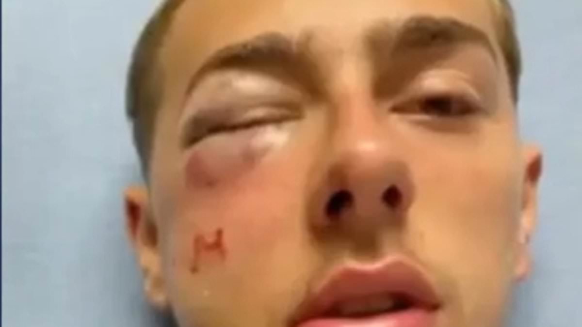 "Delaware State Trooper Faces Multiple Assault Charges for Attacking Teens"