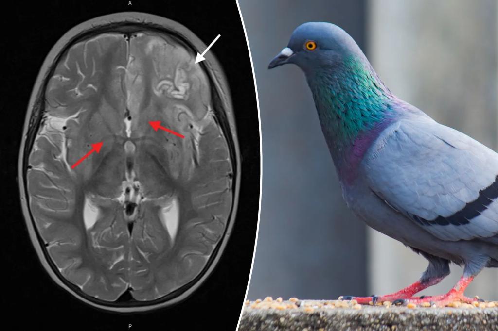Featured image for "Tragic Loss: 2-Year-Old Becomes 5th Victim of Rare Pigeon Virus"