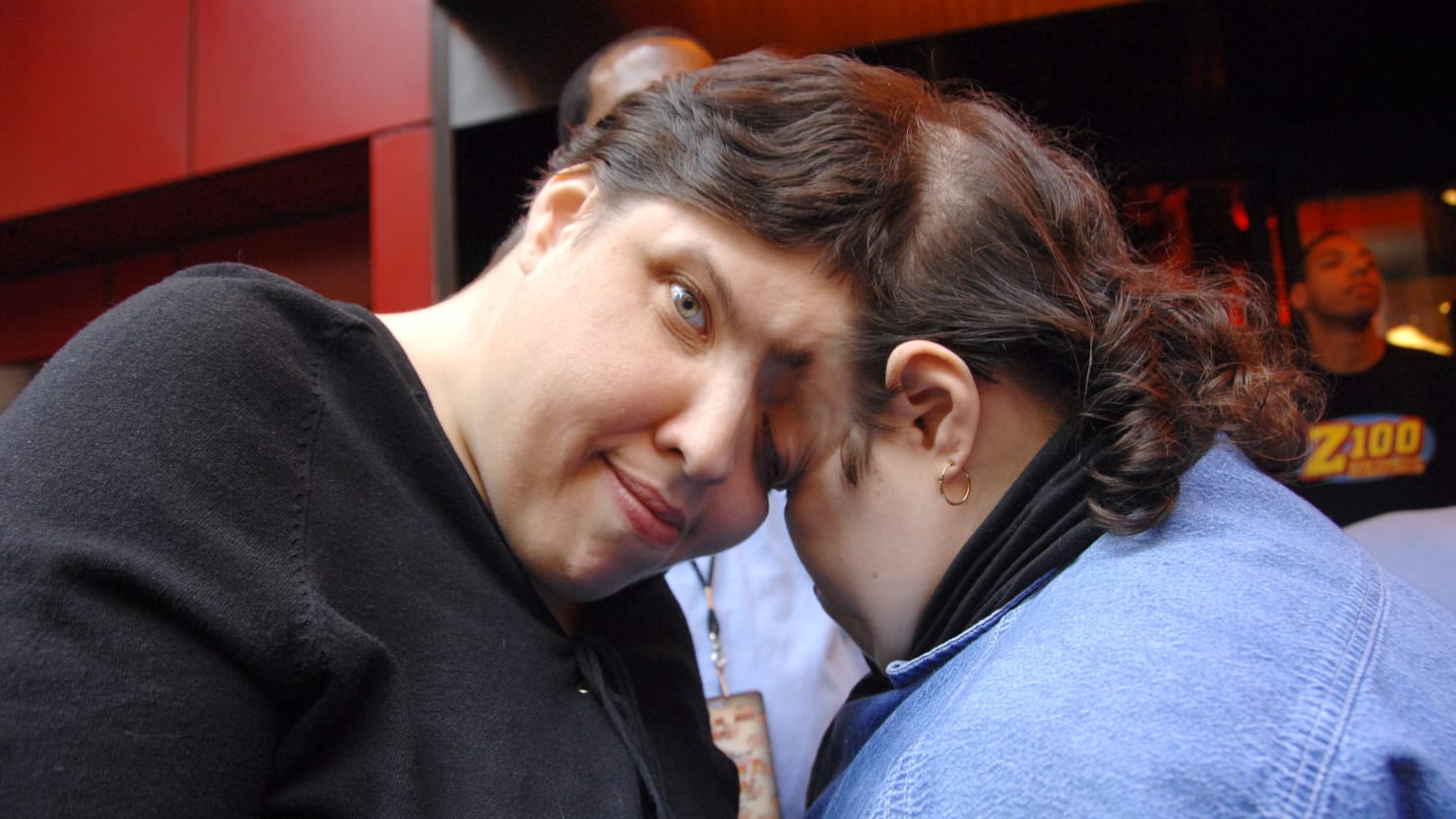 Featured image for "World's Oldest Conjoined Twins Lori and George Schappell Pass Away at 62"