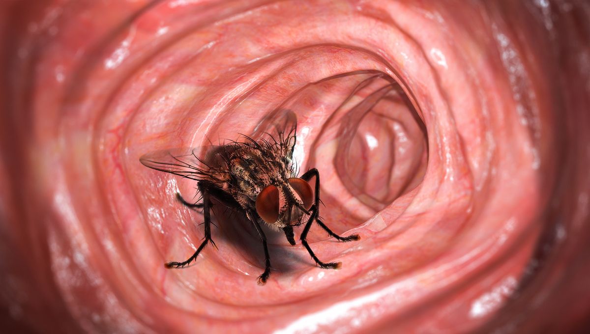 Featured image for Bizarre Discovery: Live Fly Found Inside Man's Intestines