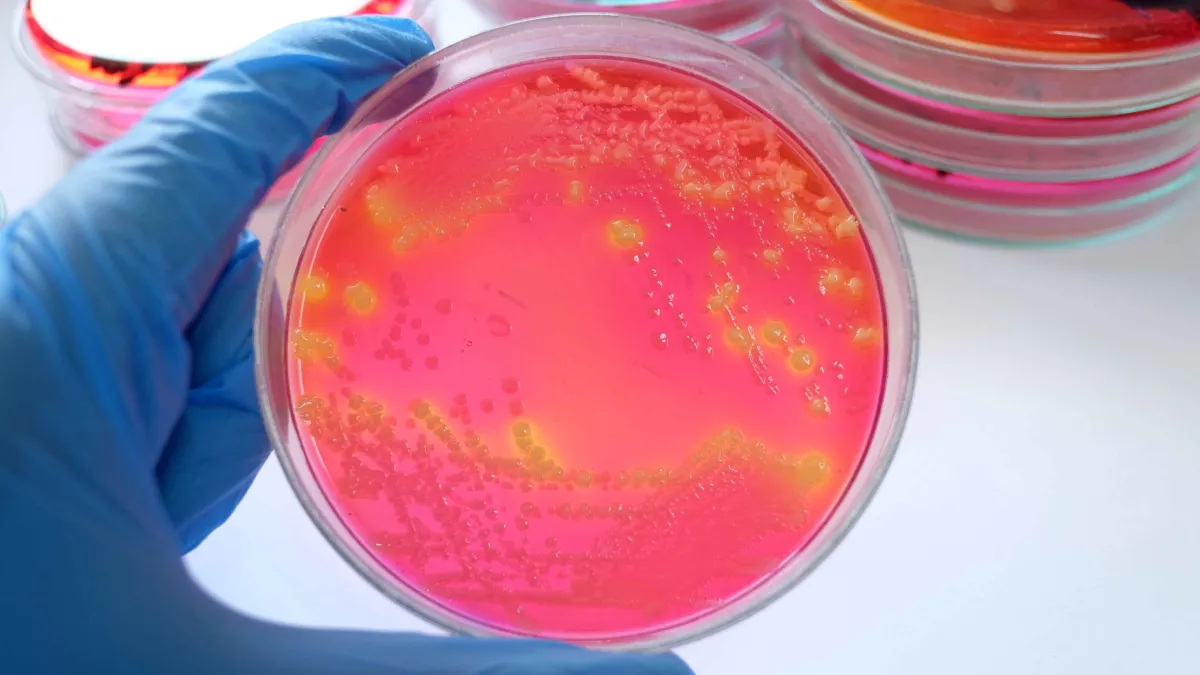 Featured image for Salmonella Outbreak at Avondale Taqueria: 20 Sickened, 10 Hospitalized