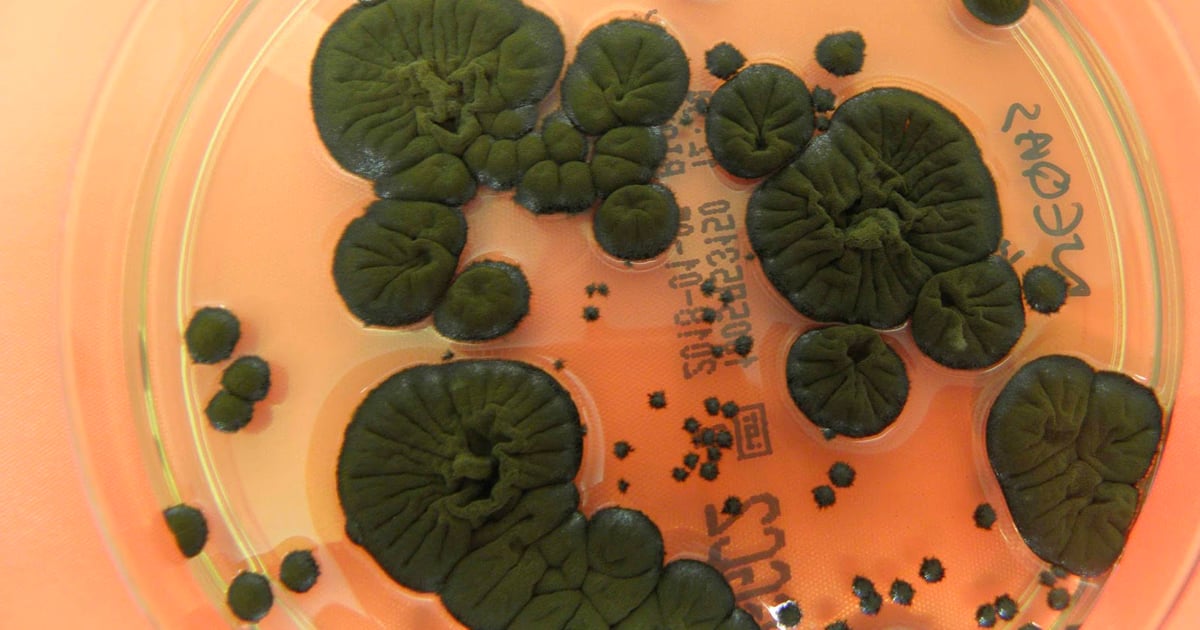 Featured image for Radiation-Absorbing Fungus Converts Nuclear Fallout into Energy