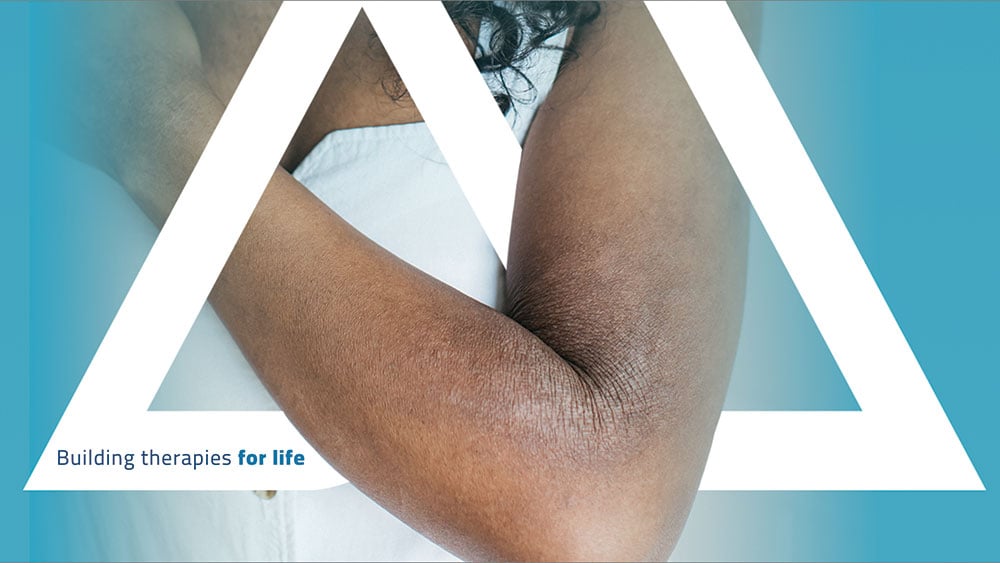 Featured image for Apogee's Eczema Drug Shows Promising Results, Challenging Industry Leaders